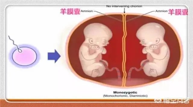 怀了双胞胎，他们会在妈妈肚子里打架吗？