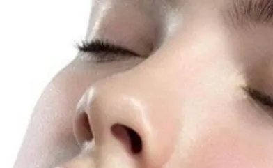 瘦鼻翼鼻头方法
