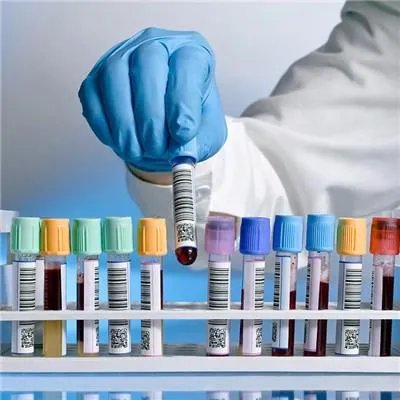 尿毒症透析的费用