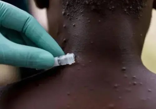 美国纽约州进入“灾难紧急状态”，这意味着什么？