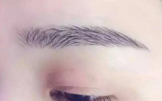 激光洗眉多少钱啊