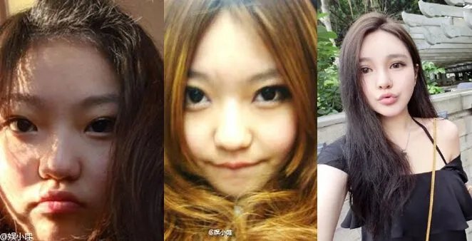 周扬青家境显赫惊人 周扬清整容前后对比照片