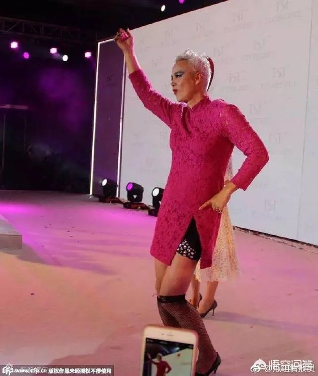 林瑞阳为什么满头白发 张庭老公像老奶奶