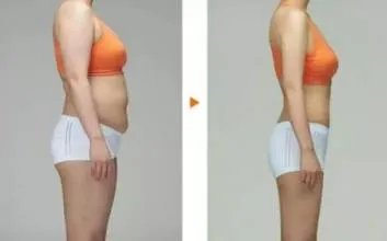 腰部抽脂手术需要的费用