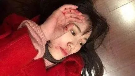 马蓉疑似“摆拍”王宝强家暴图，分手后做到体面很难吗？