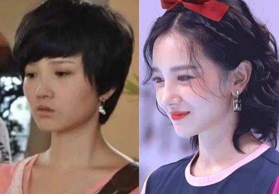 陈小纭前后对比，整骨前后对比图