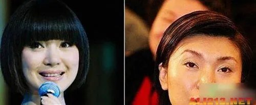绝色美女整容过度 明星也难逃老残雷人宿命
