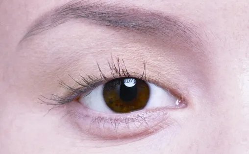 开内眼角手术一般多少钱