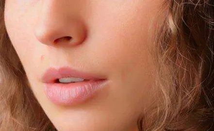 c6激光祛斑好吗