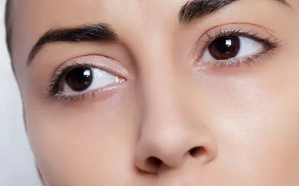 割个双眼皮要多少钱