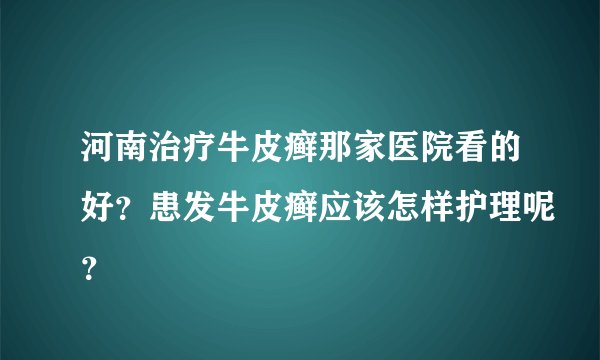河南治疗牛皮癣那家医院看的好？患发牛皮癣应该怎样护理呢？