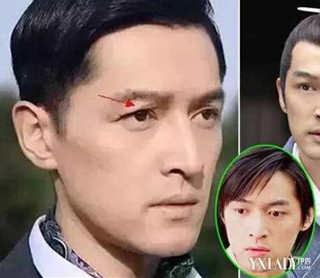 胡歌车祸前后对比照揭秘车祸诡异内幕