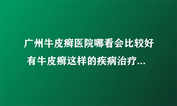 广州牛皮癣医院哪看会比较好 有牛皮癣这样的疾病治疗方法有什么呢