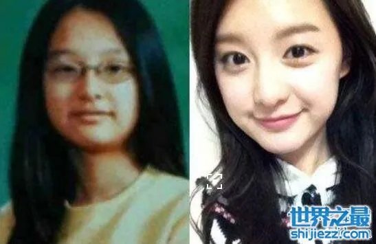 金智媛整容前后照片对比,皮肤黝黑四眼仔巨大眼袋