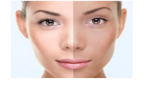 果酸美白有效果吗