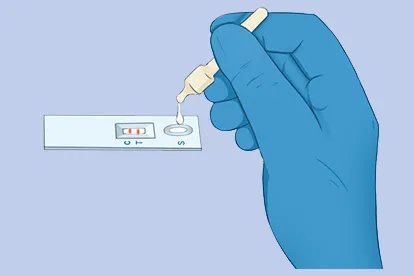 新冠症状怎么1分钟自测