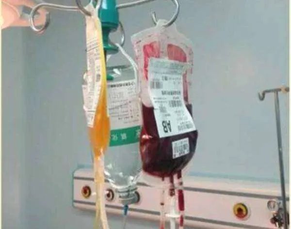 大二学生被雷击中，为什么需要全身换血？