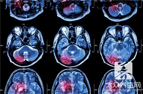 脑溢血手术后遗症如何护理呢？