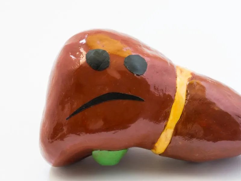 胆淤症是什么引起的