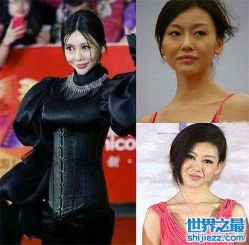 巩新亮整容前后差异大 网友直呼惨不忍睹 