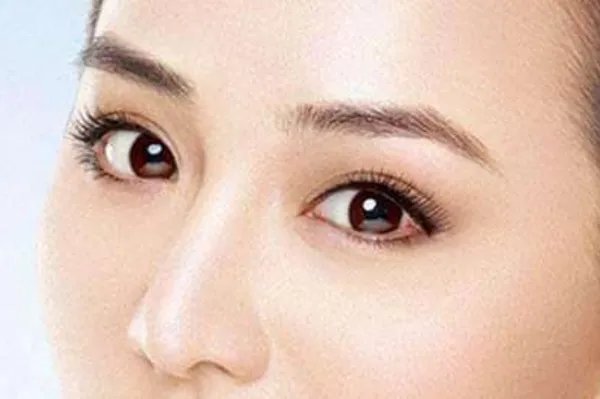 成都去眼袋口碑好的医院是哪家