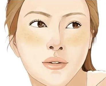 激光祛斑效果好吗