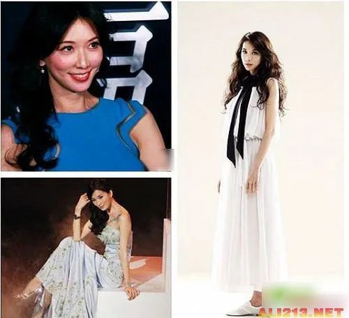 绝色美女整容过度 明星也难逃老残雷人宿命