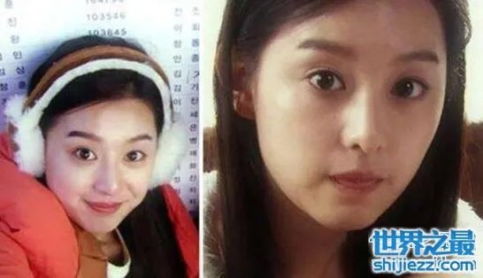 金智媛整容前后照片对比,皮肤黝黑四眼仔巨大眼袋