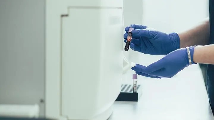 怎样区分普通感冒和新冠肺炎？区分普通感冒和新冠肺炎的办法是什么