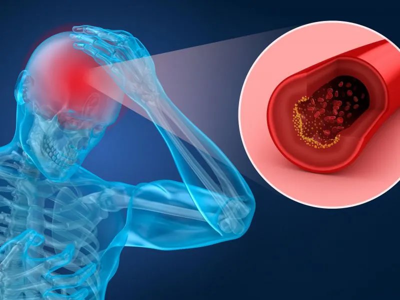 神经系统微循环疗法的治疗过程