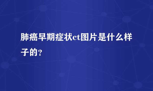 肺癌早期症状ct图片是什么样子的?