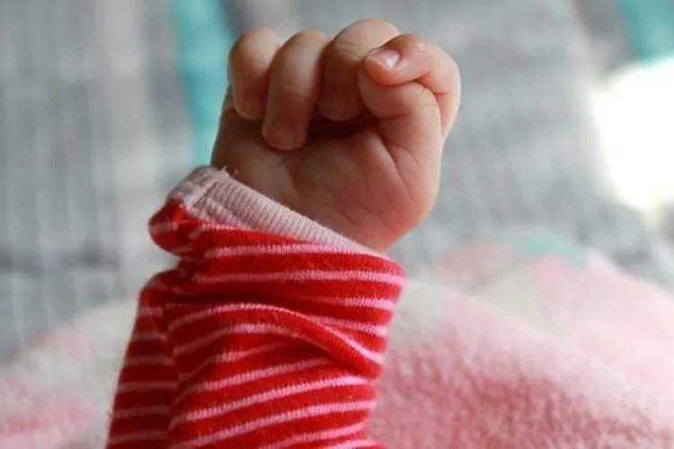 脑瘫的症状图片