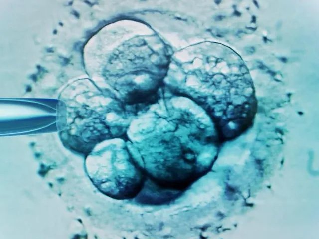 卵子是用取卵针取出来的吗？