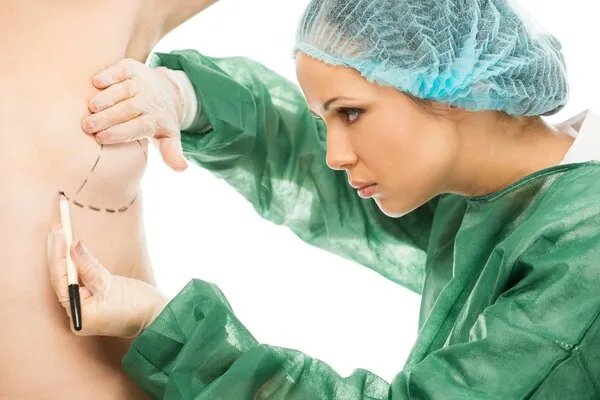 自身脂肪丰胸费用多少