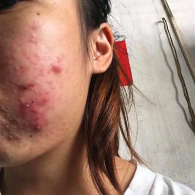 吃海带绿豆汤可以除痘祛斑？好的情绪