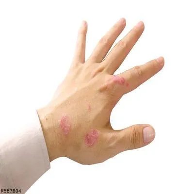 在上海看皮肤病哪家好