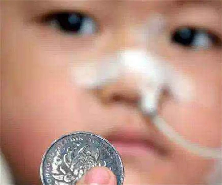 3岁女娃误吞一毛硬币，家长的什么行为差点害了她？