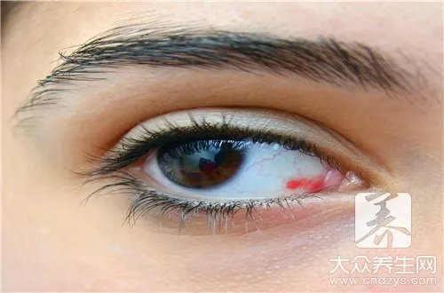 什么病能导致七窍流血