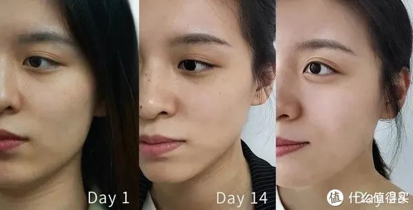 美白淡斑精华液哪个牌子比较好？十大美白祛斑产品排行榜