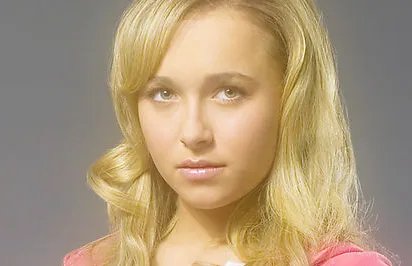 双眼皮手术后眼角增生注意事项有哪些