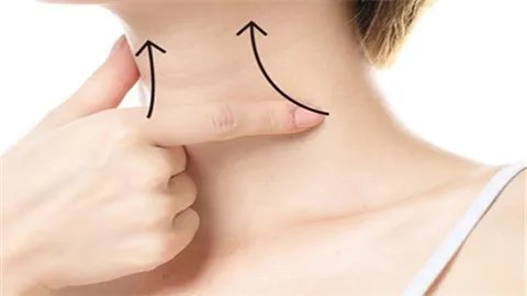 如何去脖子上的皱纹