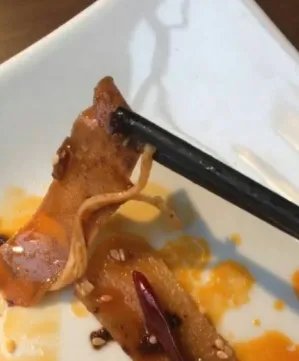 火锅店吃出了创可贴？