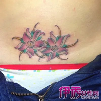 剖腹产疤痕增生图片