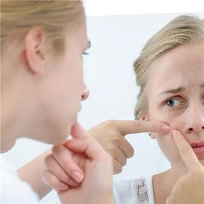 怎样可以去痘印