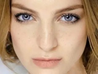 生活中常用祛斑的小窍门