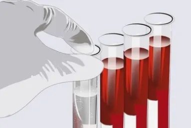 山东一男孩为给弟弟捐骨髓跑步增重，捐献骨髓需要符合哪些条件？