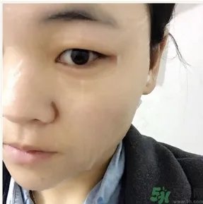 丽得姿面膜用后要洗吗？丽得姿面膜要不要洗？