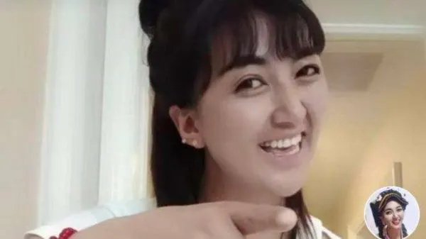 知名网红拉姆遭前夫纵火烧伤，她与前夫之间到底有何仇怨？