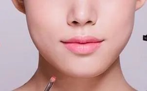 打玻尿酸除皱好不好