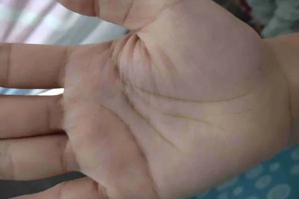 生命线越短寿命越短是真的吗？